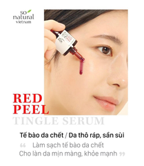So Natural - Tinh Chất Red Peel Tingle Serum 10ml (Bản cải tiến)