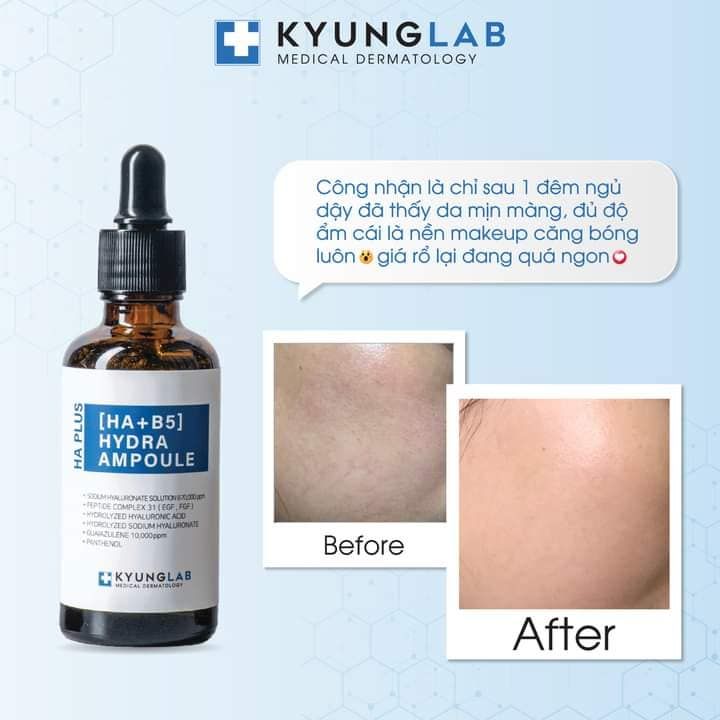 Serum HA B5 KyungLab Hydra Ampoule 50ml