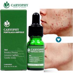 Caryophy - Serum Trị Mụn - Mờ Thâm 10ml