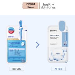 Mặt nạ Mediheal Watermide