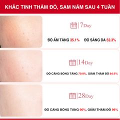 Angel's Liquid - Tinh Chất Mờ Nám Chuyên Sâu Tranexamic Mela Ampoule 30ml