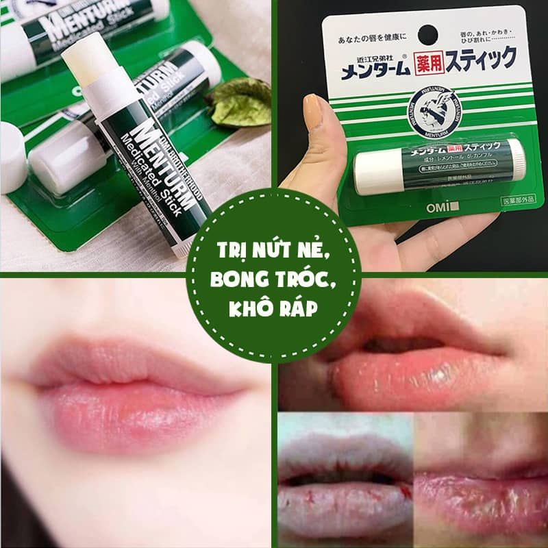 Son Dưỡng Môi Omi Menturm Nhật Bản