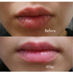 Son Dưỡng Môi Omi Menturm Nhật Bản