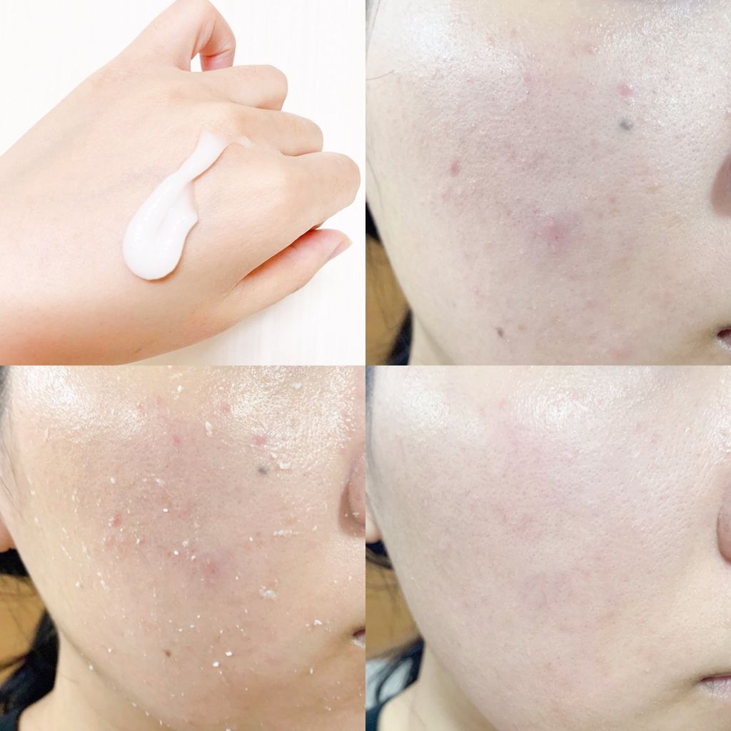Gel Tẩy Tế Bào Chết Missha Super Aqua Ultra Hyalron Peeling Gel 100ml