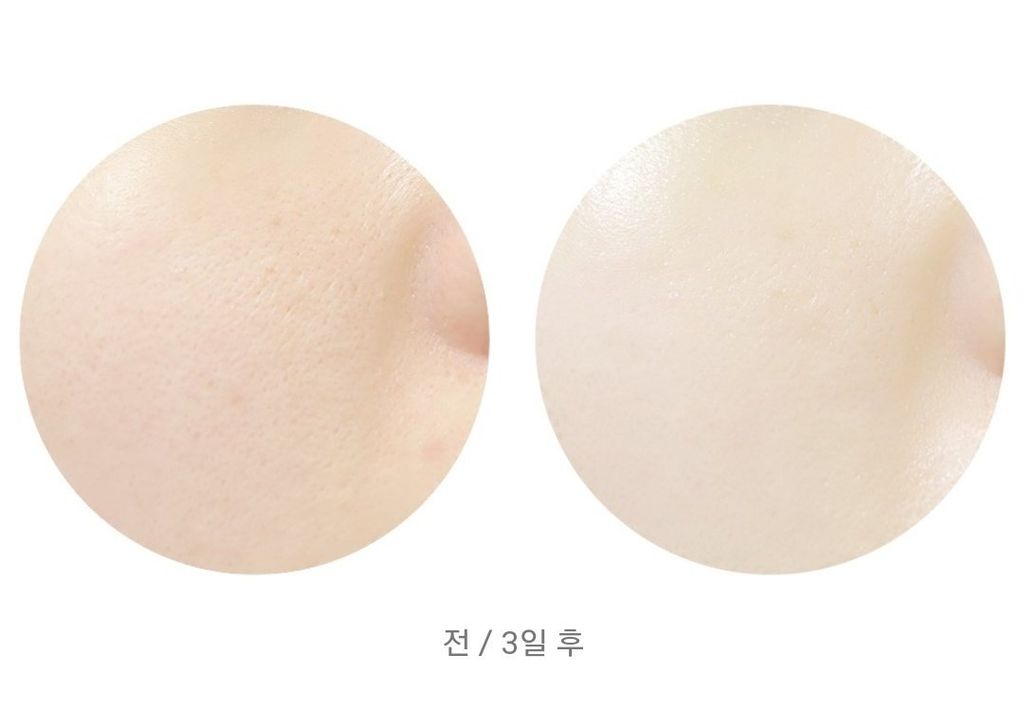 Gel Tẩy Tế Bào Chết Missha Super Aqua Ultra Hyalron Peeling Gel 100ml