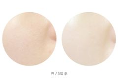 Gel Tẩy Tế Bào Chết Missha Super Aqua Ultra Hyalron Peeling Gel 100ml