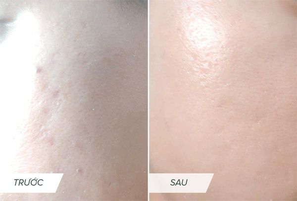 Paula's Choice - Niacinamide 10% Booster 20ml (Ko tđ)