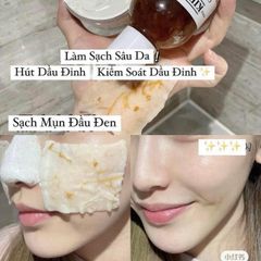 Toner hoa cúc Kiehls Calendula 75ml