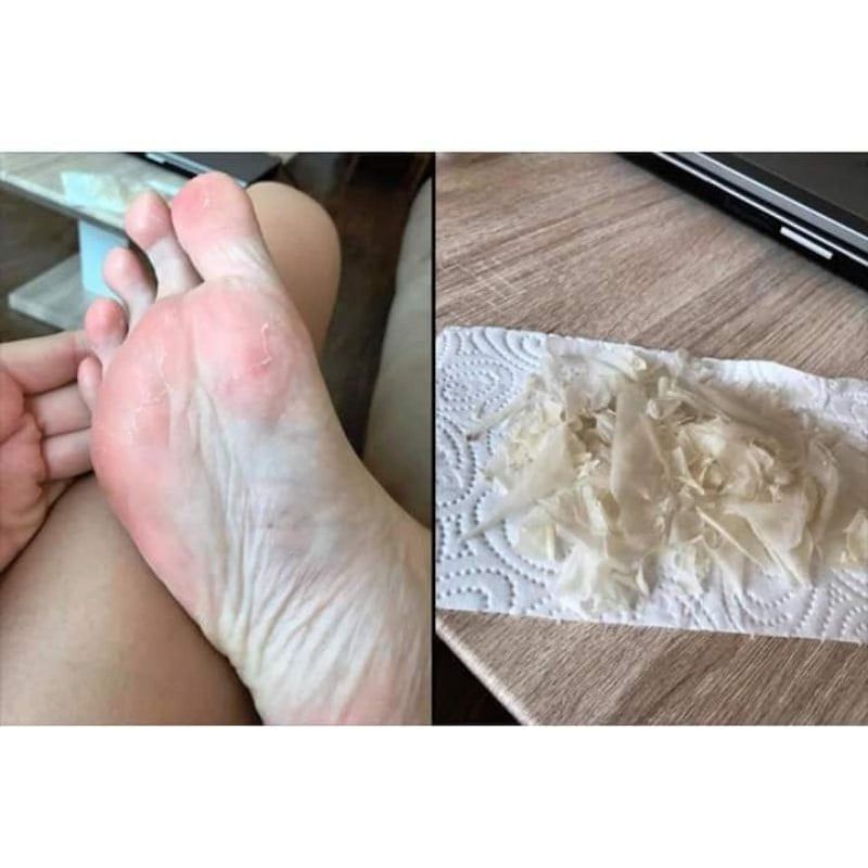 Túi Ủ Tẩy Tế Bào Chết Da Chân TO PLAN