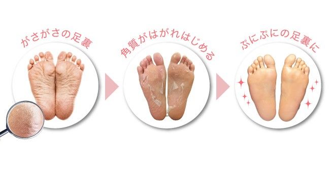 Ủ Chân DX Nhật #Xanh