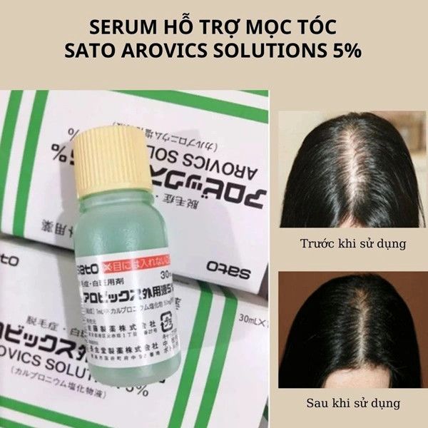 Tinh Chất Thảo Dược Kích Thích Mọc Tóc Sato 30ml