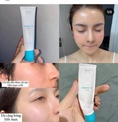 Kem Dưỡng Obagi - Retinol 1.0% Cream 28g (Ko tđ)