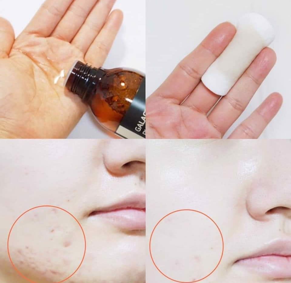 Some By Mi - Serum Pure Vitamin C Glow 30ml