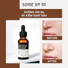 Some By Mi - Serum Pure Vitamin C Glow 30ml