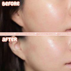 Serum Ciracle Hydra B5 Source-Wrinkle 30ml