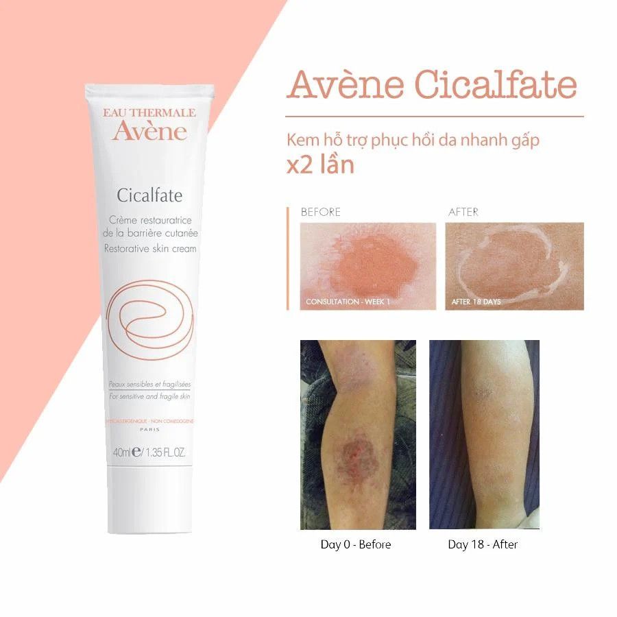 Avene - Kem Phục Hồi Da Avene Cicalfate Repair Cream 40ml