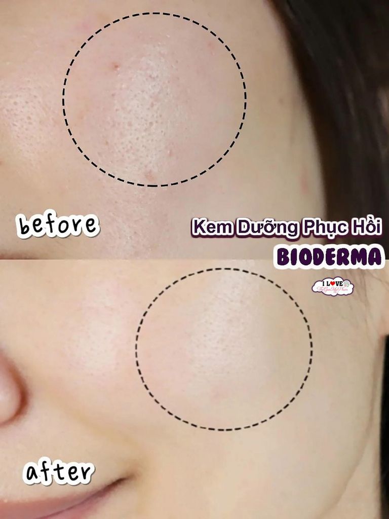 Kem phục hồi Bioderma Cicabio 100ml
