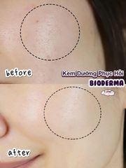 Kem phục hồi Bioderma Cicabio 100ml