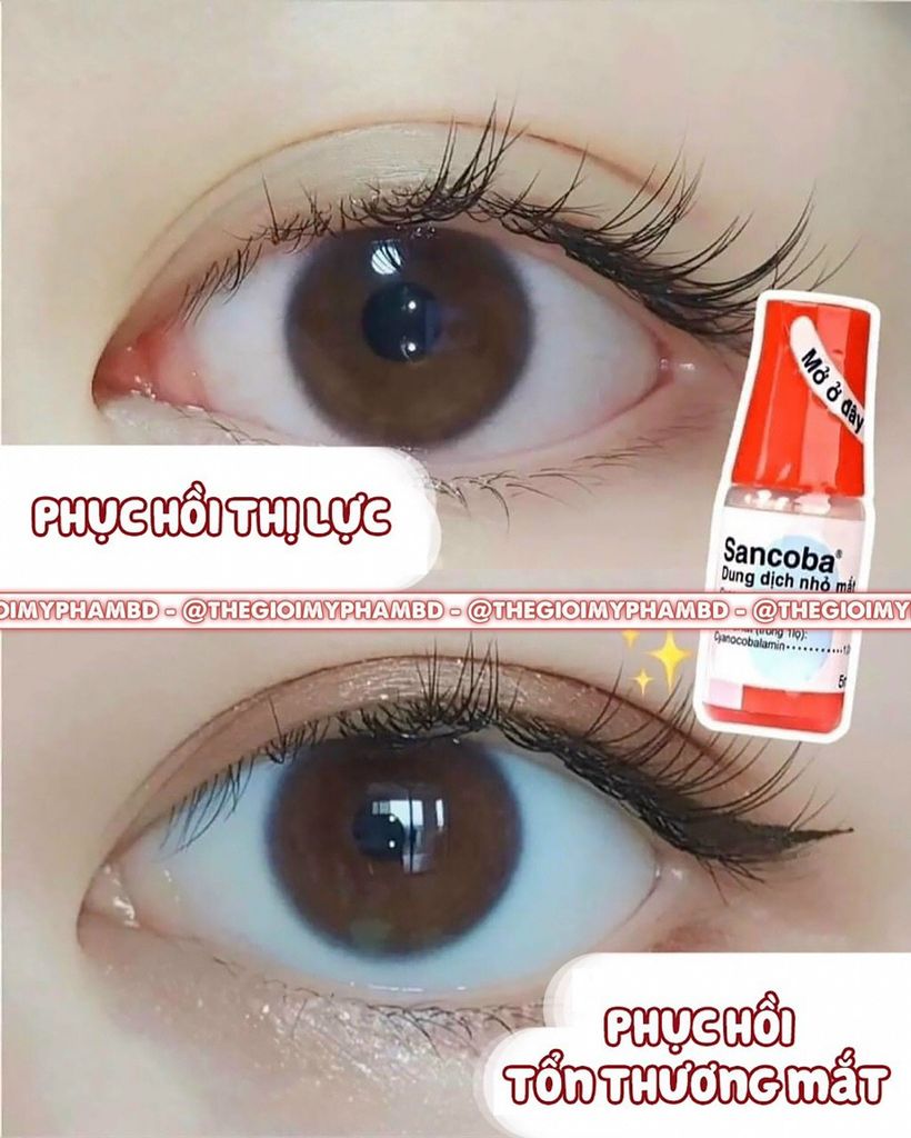 Thuốc nhỏ mắt chống cận thị, phục hồi thị lực Santen Sancoba 5ml