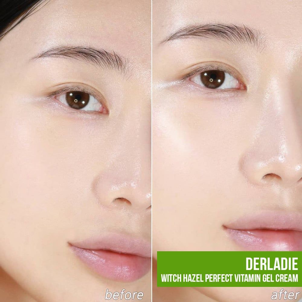 Kem Derladie Witch Hazel Perfect Vitamin Gel 55ml