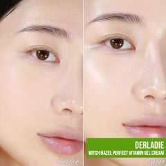Kem Derladie Witch Hazel Perfect Vitamin Gel 55ml