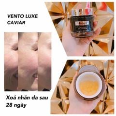 Serum Trứng Cá Tầm Vento Vivere Luxe Caviar Cellular Serum Thụy Sĩ 30g (Ko tđ)