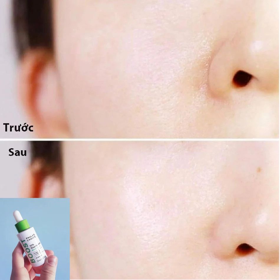 Paula's Choice - Niacinamide 10% Booster 20ml (Ko tđ)