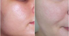 Paula Choice - Niacinamide 20% Treatment 20ml (Ko tđ)