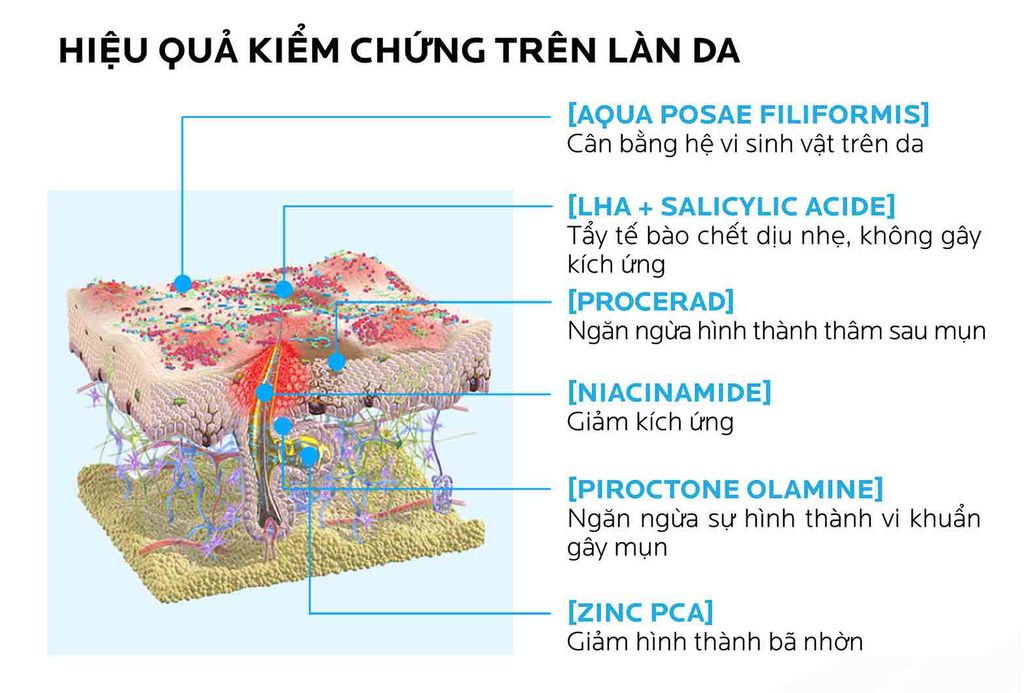 Laroche Posay - Kem Trị Mụn Duo+ 3ml (Mini)