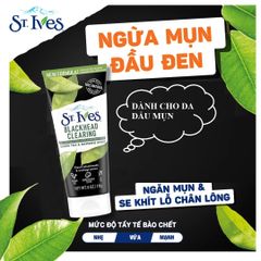 Tẩy Tế Bào Chết Mặt St.ives Trà Xanh 170g