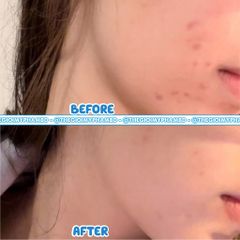 Laroche Posay - Gel Rửa Mặt Cho Da Dầu Nhạy Cảm 200ml