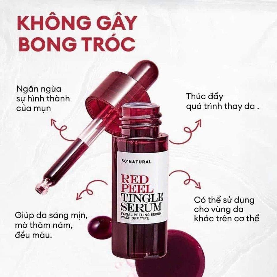 So Natural - Tinh Chất Red Peel Tingle Serum 10ml (Bản cải tiến)