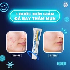 Gel Trị Mụn - Giảm Thâm Actidem Derma Gel 18g