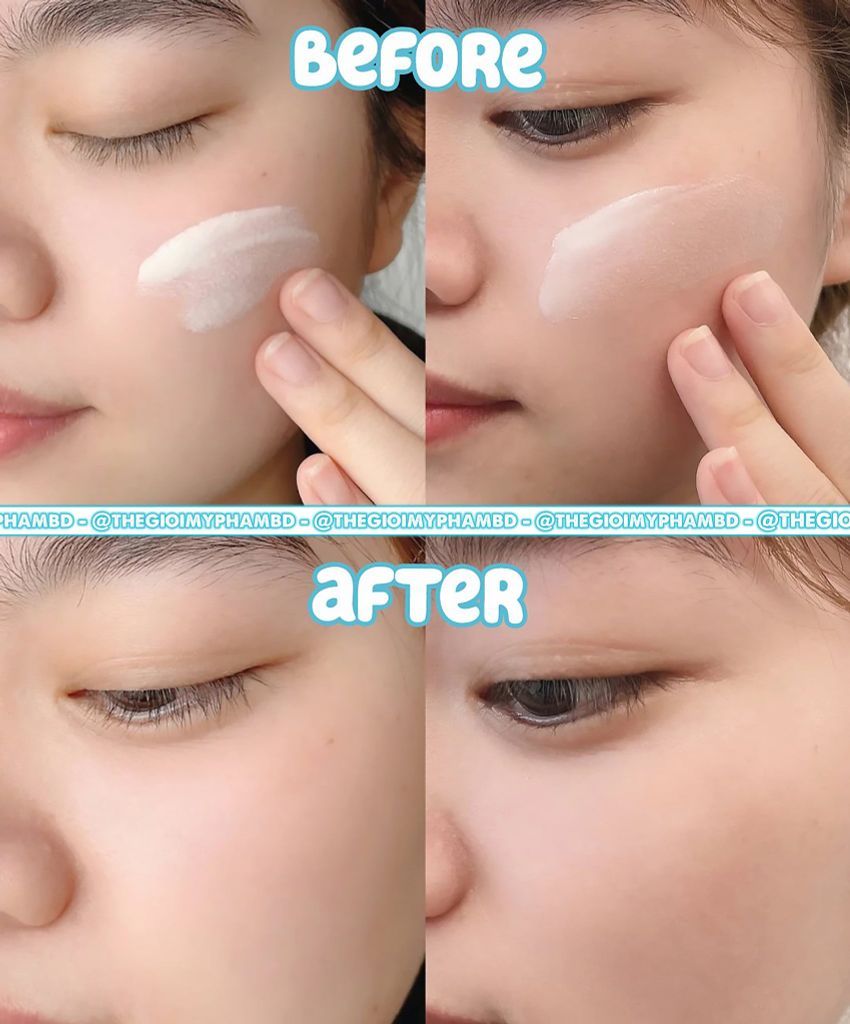 Laroche Posay - KCN Oil Correct Daily Gel-Cream 50ml