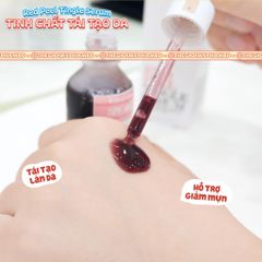 So Natural - Tinh Chất Red Peel Tingle Serum 35ml