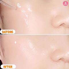 Serum Derladie Witch Hazel 35ml SALE 420K>388K