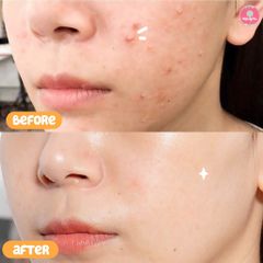 Serum Derladie Witch Hazel 35ml SALE 420K>388K