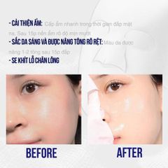 Sur.Medic - Nạ Super Glutathione 100 BrightMask