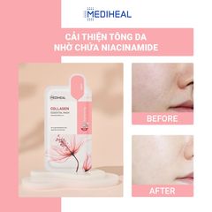 Mặt Nạ Mediheal Essential Mask #Collagen