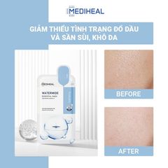 Mặt Nạ Mediheal Essential Mask #Watermide