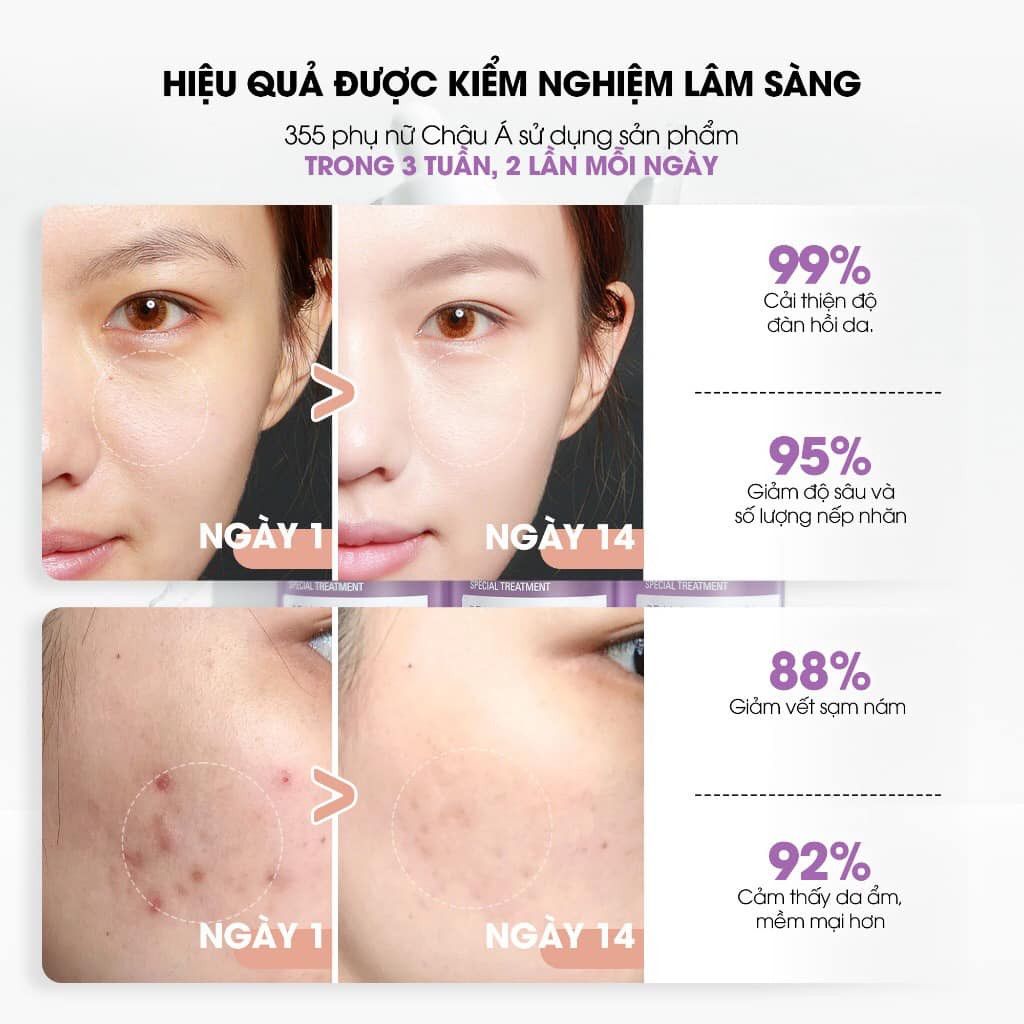 Serum Neogen Dermalogy Real Bakuchiol Ngừa Lão Hoá, Mờ Nếp Nhăn 30ml