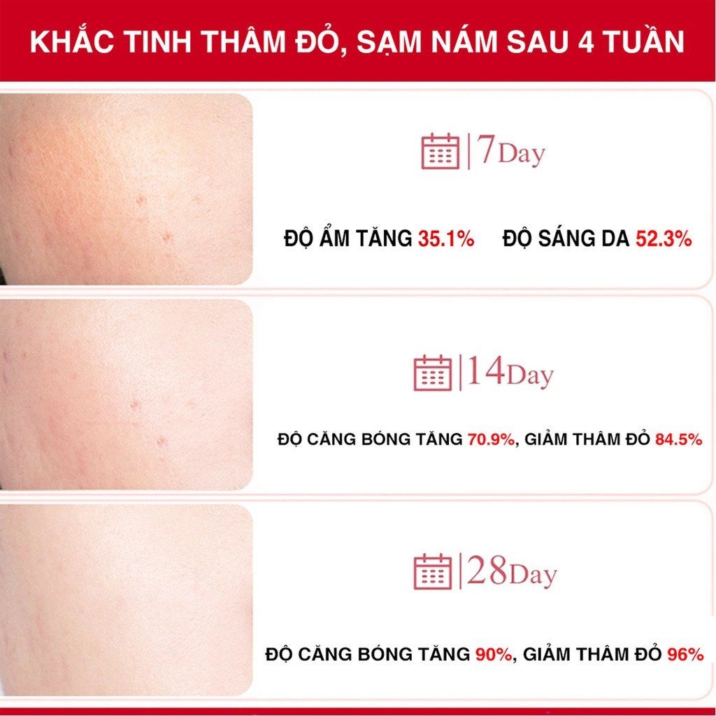 Tinh Chất Trị Nám Angel's Liquid Tranexamic Mela Zero Ampoule 30ml