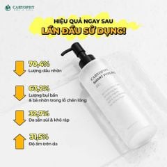 Caryophy - Gel Tẩy Tế Bào Chết Ngăn Ngừa Mụn Smart Peeling Gel 250ml