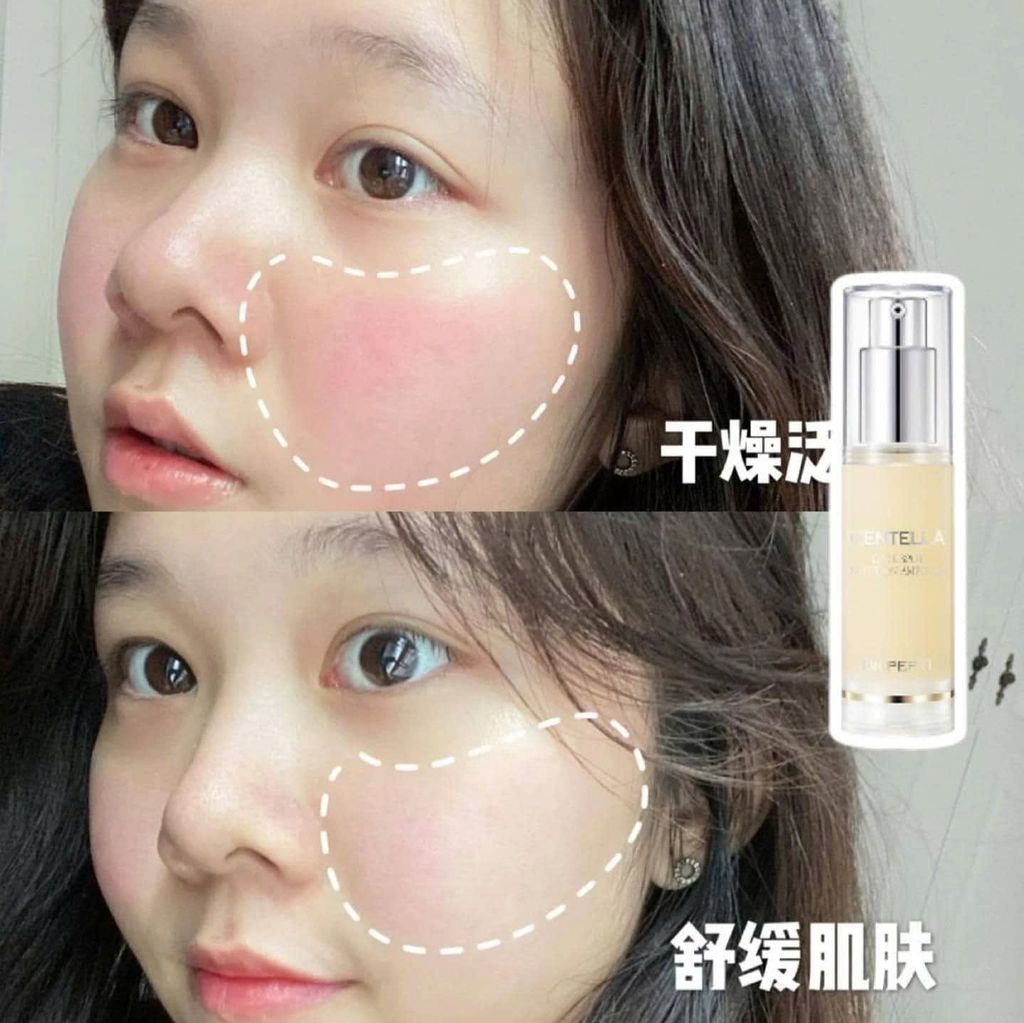 Tinh Chất Dưỡng Sáng Dr.Pepti+ Centella Dark Spot Solution Ampoule 30ml