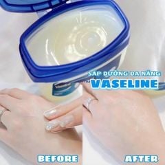 Sáp Dưỡng Ẩm Vaseline Pure Petroleum Jelly 100ml