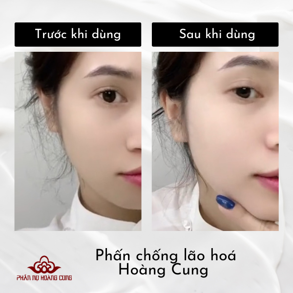 Combo Dưỡng Da Phấn Chống Lão Hóa + Phấn Ngừa Mụn - PHẤN NỤ HOÀNG CUNG