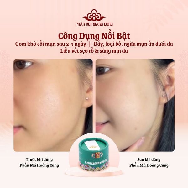 Hình ảnh sản phẩm