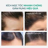  Dầu gội dưỡng tóc bưởi xanh – kích thích mọc tóc, ngăn ngừa rụng tóc Vitacare 