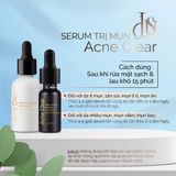  Serum giảm mụn mờ thâm Miracle Serum Acne Clear Love Your Skin 