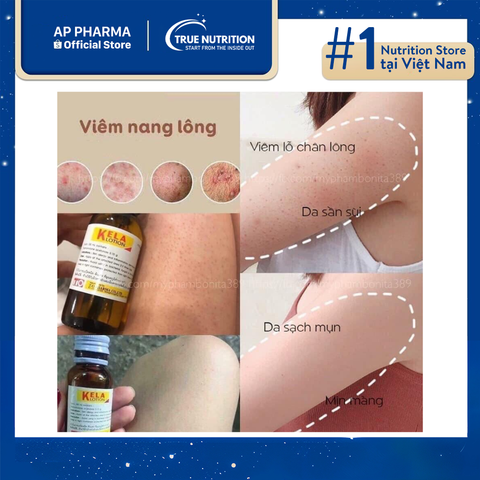 Kela Lotion Thailand – Giải pháp hỗ trợ điều trị viêm lỗ chân lông hiệu quả